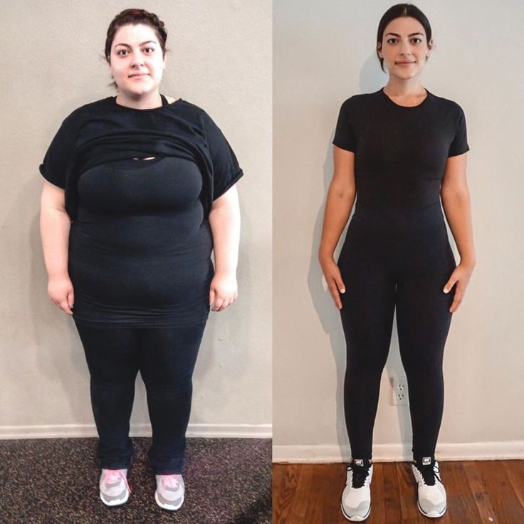 Emily R. before and after weight loss transformation